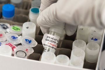 Des jumelles de 37 ans meurent du coronavirus à trois jours d'intervalle