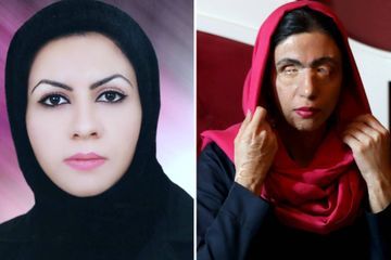 Dix ans après avoir été attaquée à l'acide, Masoumeh devient mannequin