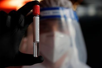 30.000 nouveaux cas en France, dernières heures avant le couvre-feu... le point sur le coronavirus