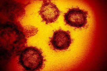 Coronavirus : l'Institut Pasteur développe plusieurs tests sérologiques