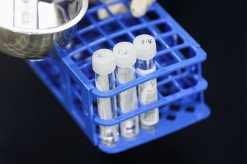 Covid: le Royaume-Uni approuve le traitement de GSK