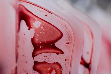 Des microplastiques détectés dans du sang humain, une première, selon une étude