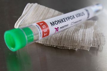 Pas d'inquiétude pour l'instant que la variole du singe provoque une pandémie, rassure l'OMS