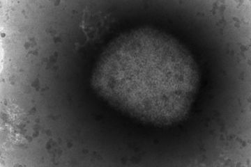 Plus de 1.450 cas de variole du singe confirmés en France
