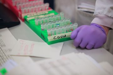Premier essai clinique en cours aux Etats-Unis pour un vaccin contre le coronavirus