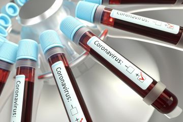 Premiers cas de coronavirus déclarés en Autriche