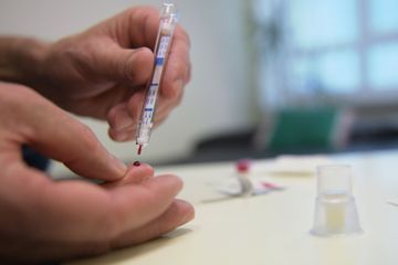 Sida: rémission d'un patient séropositif sans greffe de moelle