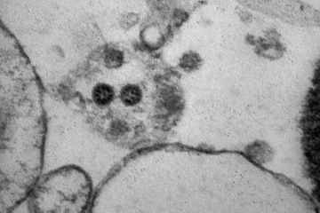 Variant Omicron: Pasteur confirme la nécessité d'une dose de rappel de vaccin à ARN