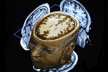 On a trouvé les neurones du temps