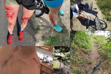 Lorraine : des promeneurs se plaignent d'être piégés lors de balades en vélo