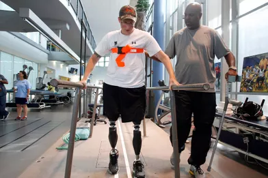 Une longue rééducation est nécessaire pour réapprendre à marcher avec des jambes artificielles.