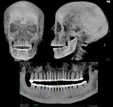 La radiographie de sa mâchoire révèle une dentition en très bon état.