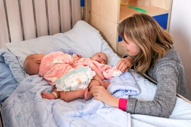 James Et Harley Les Bebes Siamois Sauves Par L Imprimante 3d