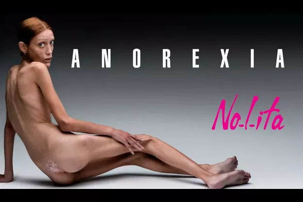 Isabelle-Caro.-L-anorexie-l-a-tuee.jpg