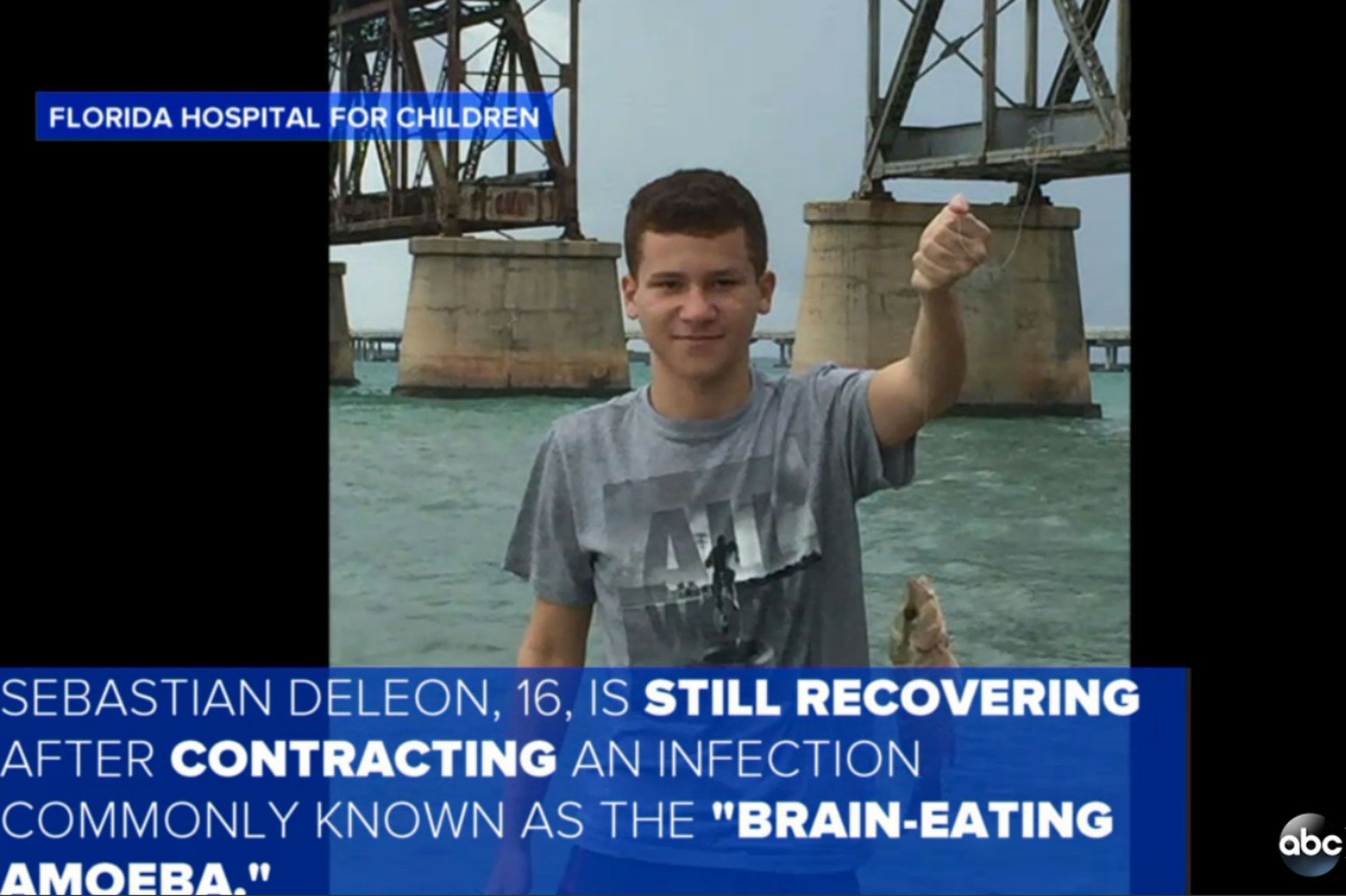 sebastian 16 ans survit a l amibe mangeuse de cerveau