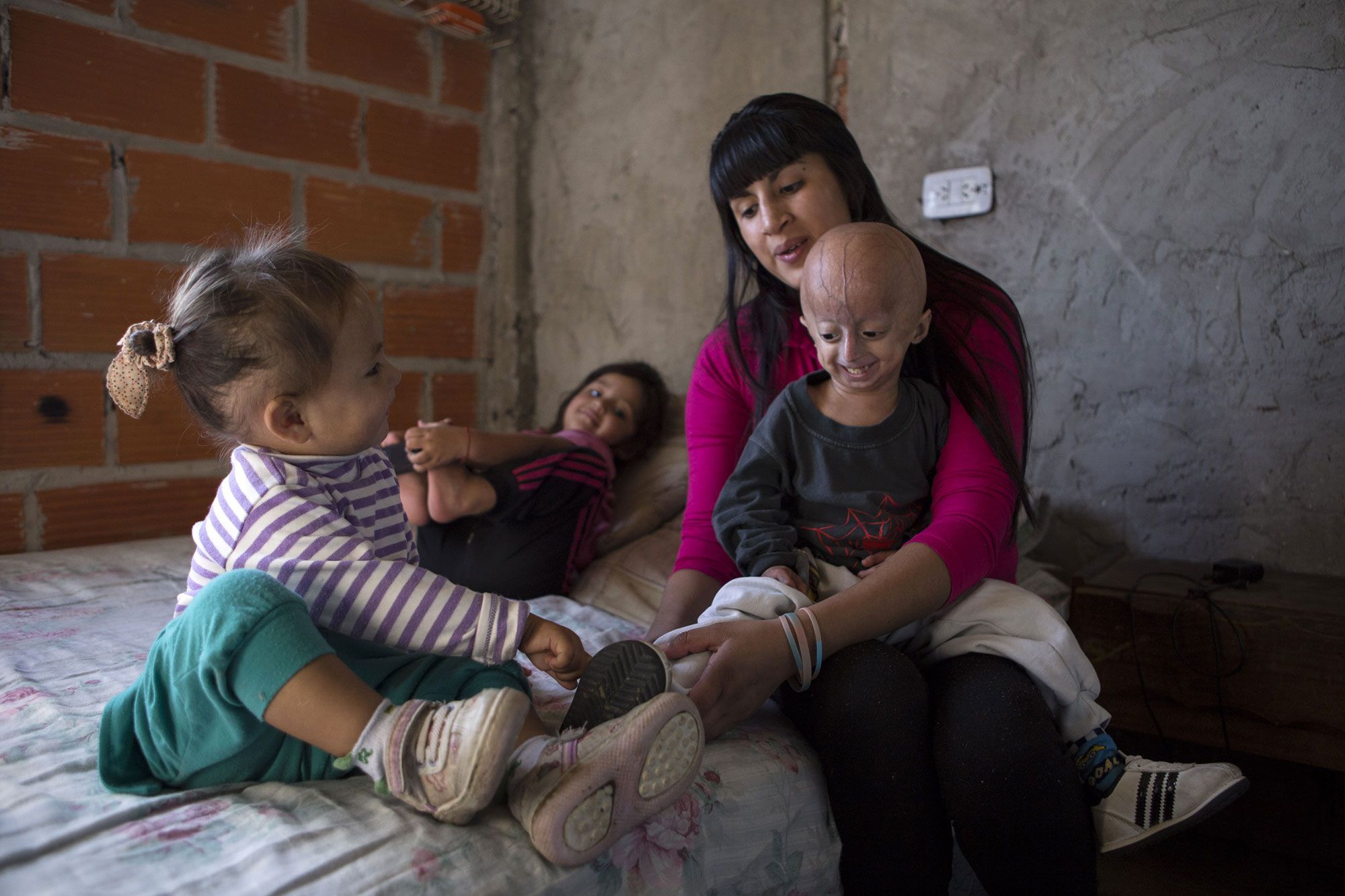 Maladie Rare Franco Villavicencio L Enfant Vieillard D Argentine