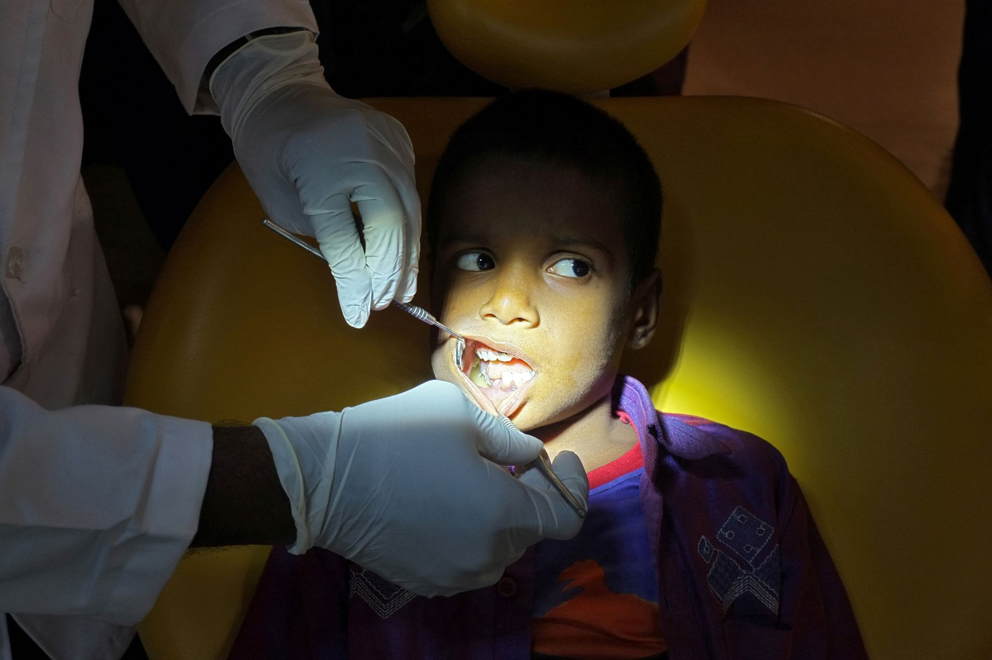 Inde Un Jeune Enfant Opere De Ses 526 Dents