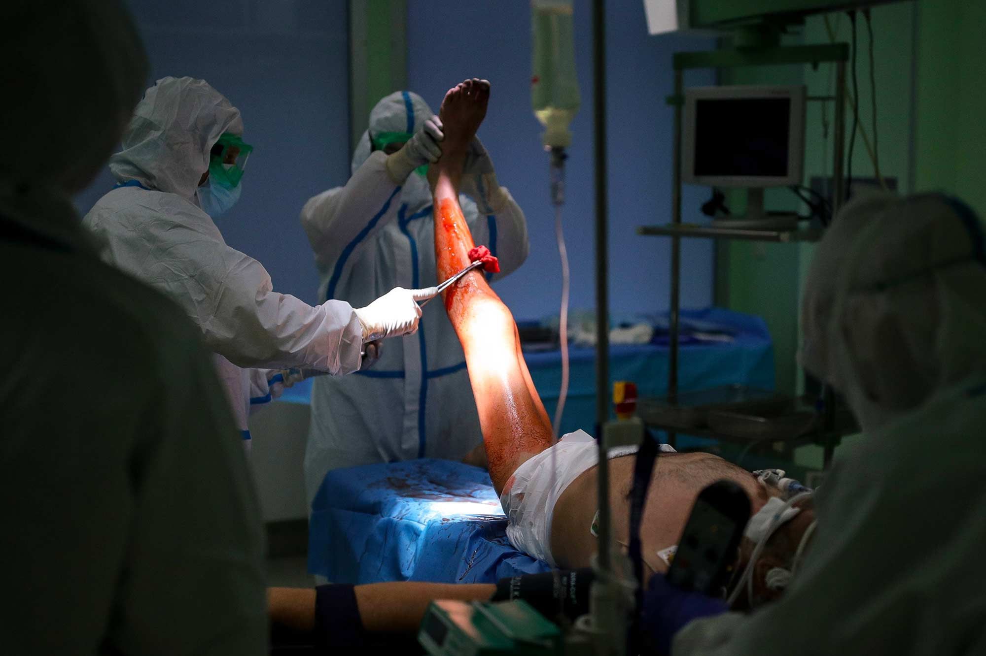 une chirurgienne autrichienne condamnee pour avoir ampute la mauvaise jambe