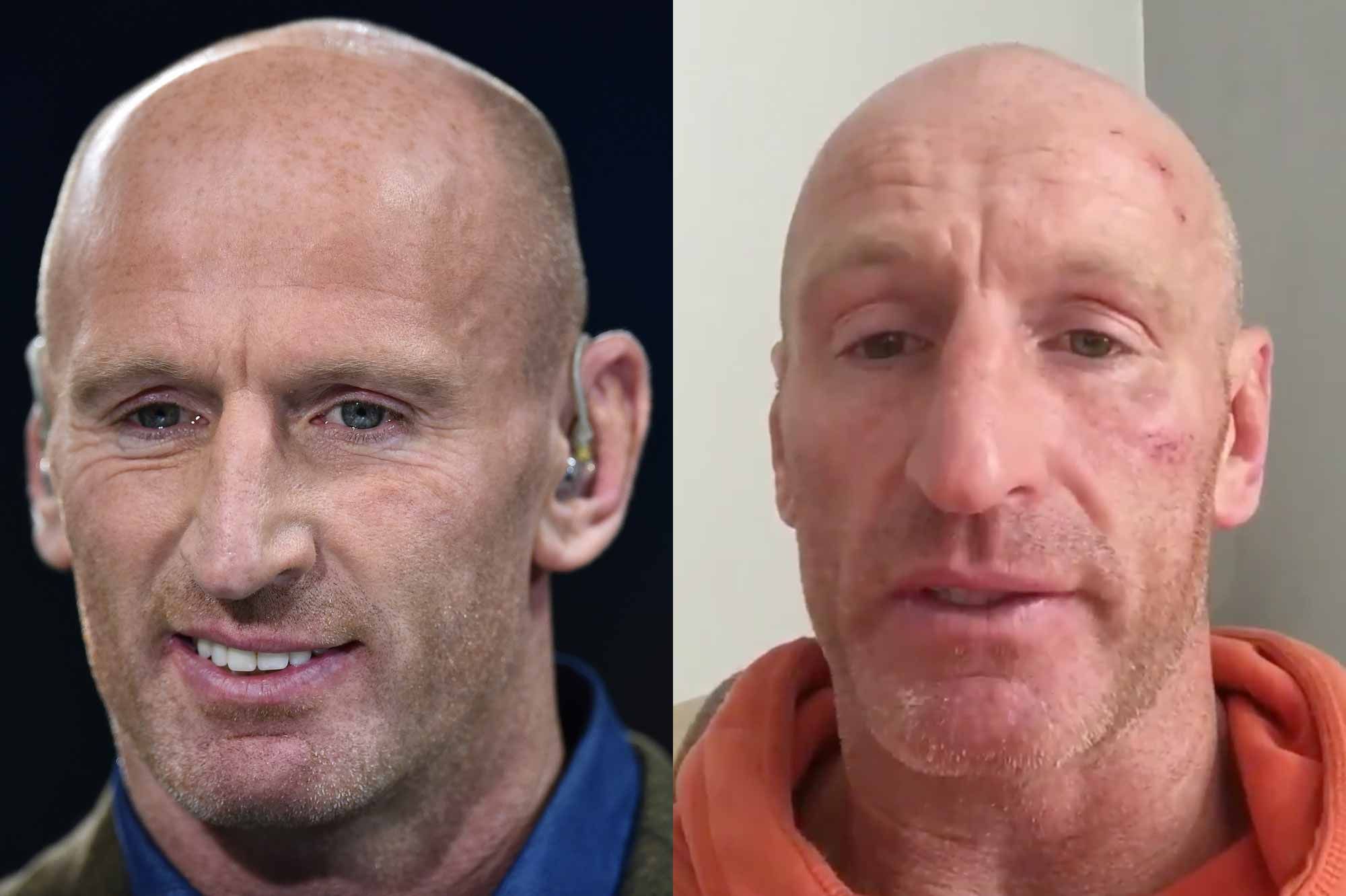 L Ancien Rugbyman Gareth Thomas Victime D Une Agression Homophobe