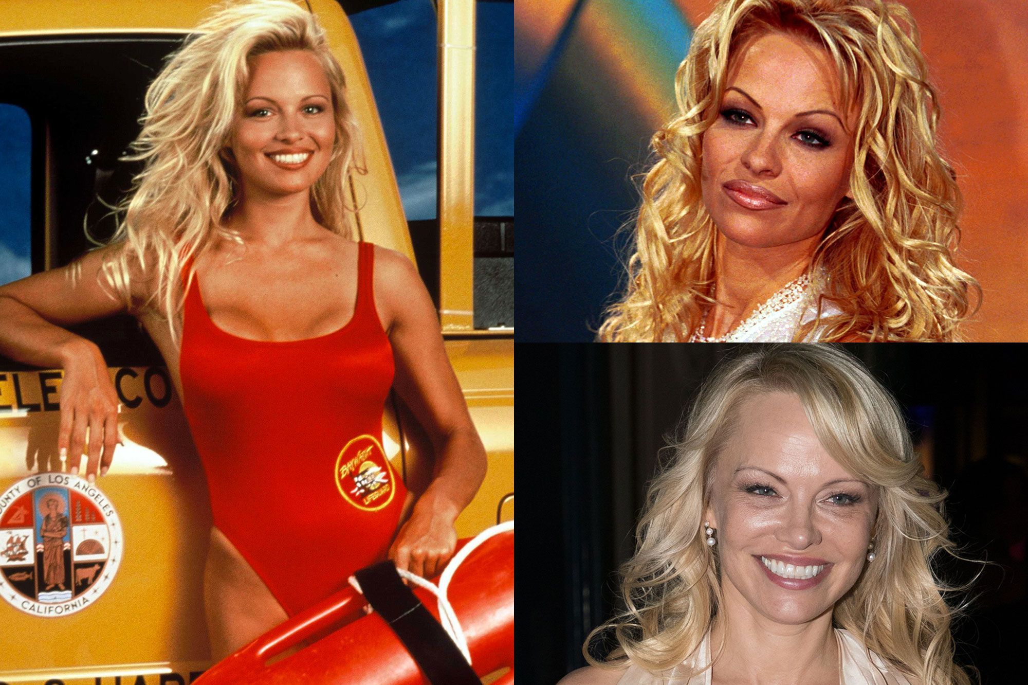 Alerte A Malibu L Evolution Physique De Pamela Anderson