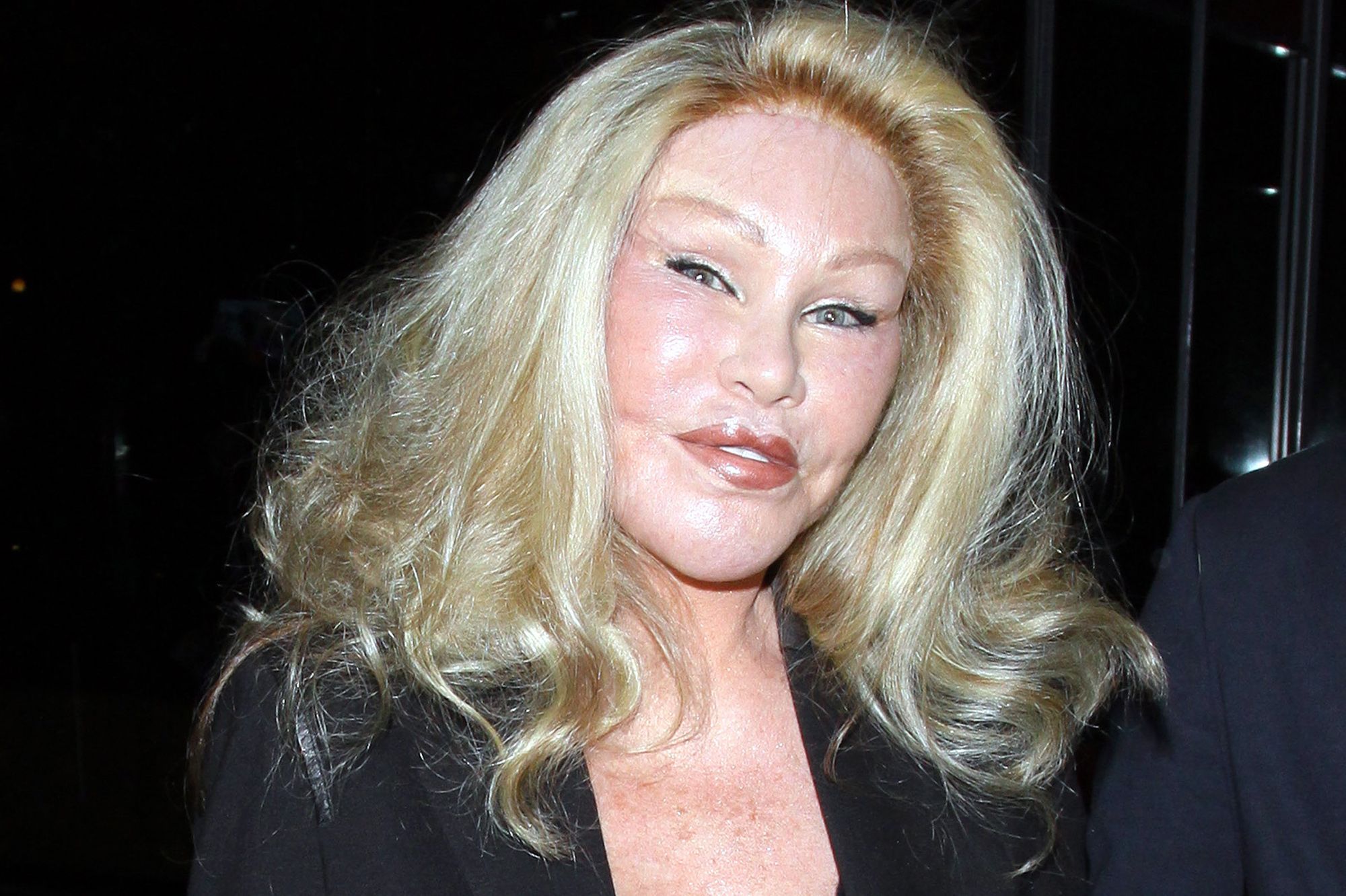 Jocelyn Wildenstein Une Femme Ruinee