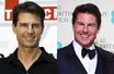 L'évolution physique de Tom Cruise - A-t-il eu recours au Botox ?