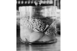 Le cerveau d'un criminel conservé par des chercheurs en 1930. 