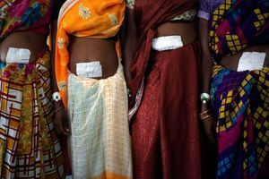 Des femmes ayant subi la stérilisation à la clinique de Bilaspur. 