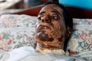 Abdul Karim Madani Atta, 20 ans, victime de la répression au Soudan.