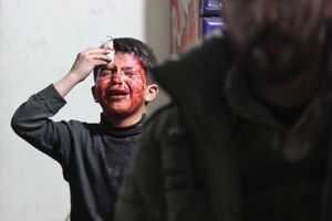 Un petit garçon blessé dans des frappes que les activistes attribuent aux forces d'Assad, à Douma, vendredi. 
