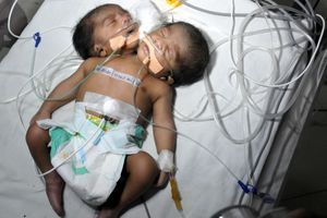 Le nouveau-né à l'hôpital de Jaipur, en Inde.