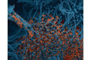 Echantillon de cellules de bronche élevées en culture et colorisées, en bleu. En orange, le virus.