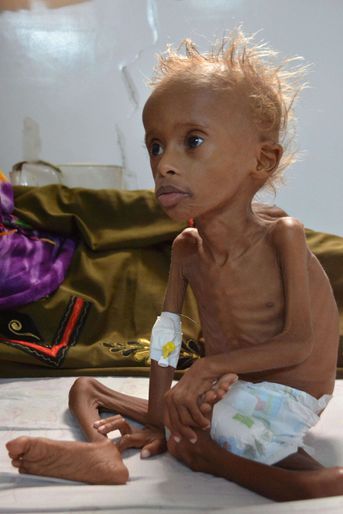 Salem, 5 ans, photographié à Sanaa, le 9 septembre 2016. 