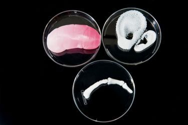 Le prototype de rein (à gauche) fabriqué par Anthony Atala et les structures en collagène, oreille et doigt, sur lesquelles les cellules souches vont se reproduire.