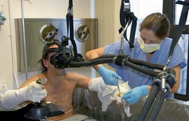La rélité virtuelle comme anesthésiant pendant une opération chirurgicale à la main.