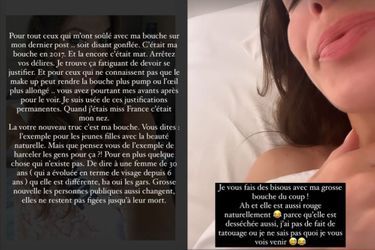 Iris Mittenaere répond une fois de plus aux critiques sur son physique, sur Instagram le 26 mars 2023.