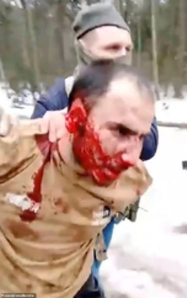 Saidakrami M. Rachabalizoda comparaît, lui aussi, le 24 mars (photo suivante). La veille, lors de son arrestation près de Briansk, les policiers se filment en train de lui couper un bout d’oreille puis diffusent la vidéo.