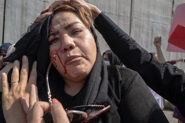La journaliste et défenseure des droits Rabia Sadat est blessée à la tête. La manœuvre a réussi : les femmes, jusqu’ici en première ligne, n’osent plus manifester.