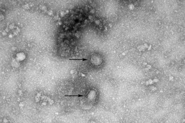Cette image, diffusée par le Centre coréen pour le contrôle et la prévention des maladies, montre la nouvelle souche de coronavirus en provenance de Wuhan, en Chine.