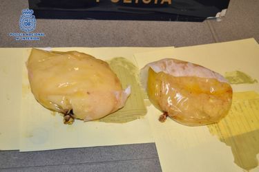 De Bogota à Barcelone, la cocaïne voyage dans les implants mammaires (décembre 2012).