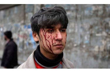 Un attentat suicide a eu lieu mercredi à l'entrée d'un complexe des services secrets afghans dans le centre de Kaboul. Deux gardes et cinq kamikazes ont été tués, et des dizaines de personnes ont été blessées.