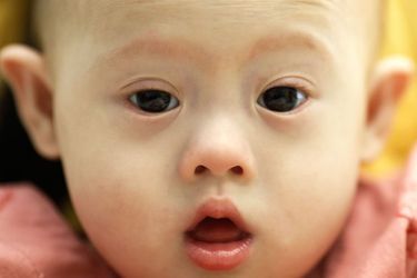 Les Parents De Gammy Donnent Leur Version Bebe Trisomique Abandonne