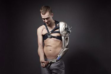 James Young et son bras bionique
