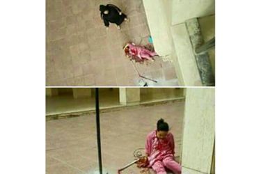 Les photos prises par une proche de Melirose Balagosa après qu&#039;elle a été jetée par la fenêtre par son patron le 6 octobre au Koweït. 