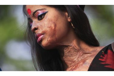 Hasina, une jeune survivante d&#039;une attaque à l’acide, prend part à un rassemblement de sensibilisation sur les violences faites aux femmes à Dhaka, au Bangladesh, à l’occasion de la Journée internationale de la femme.