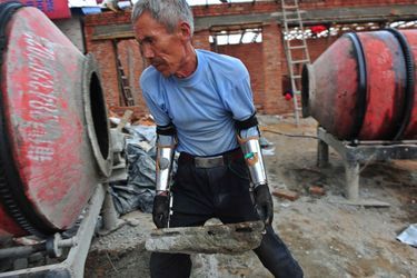 Sun Jifa et ses prothèses de métal, plastique et caoutchouc