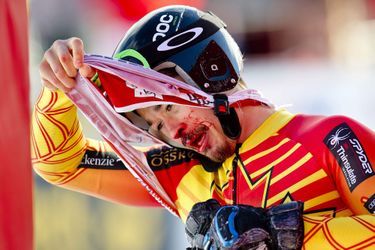 Le Canadien Morgan Pridy, ici à l&#039;arrivée saignant du nez, n&#039;a pas terminé le super-G de la Coupe du monde messieurs de ski alpin, dimanche, à Kvitfjell.