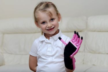 Haley, 5 ans, a bénéficié d'une main fabriquée grâce à une imprimante 3D