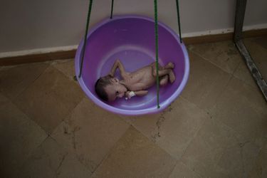 L’heure de la pesée, à l’hôpital de Saada. Les enfants souffrant de malnutrition sont nourris par intraveineuse. Encore faut-il qu’ils arrivent jusque-là. Plus de la moitié des centres de soins du pays ont fermé
