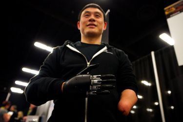 La prothèse robotisée de Mincheng Ni fabriquée par Brain Robotics.